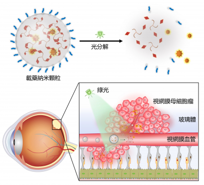 The research team developed a green light-responsive nanocarrier based on the self-assembly of photocleavable three-legged molecules. After intravenous injection of drug-loaded nanocarriers, the light-triggered drug release in retinoblastoma exhibited significant anticancer efficacy and minimal side effects.